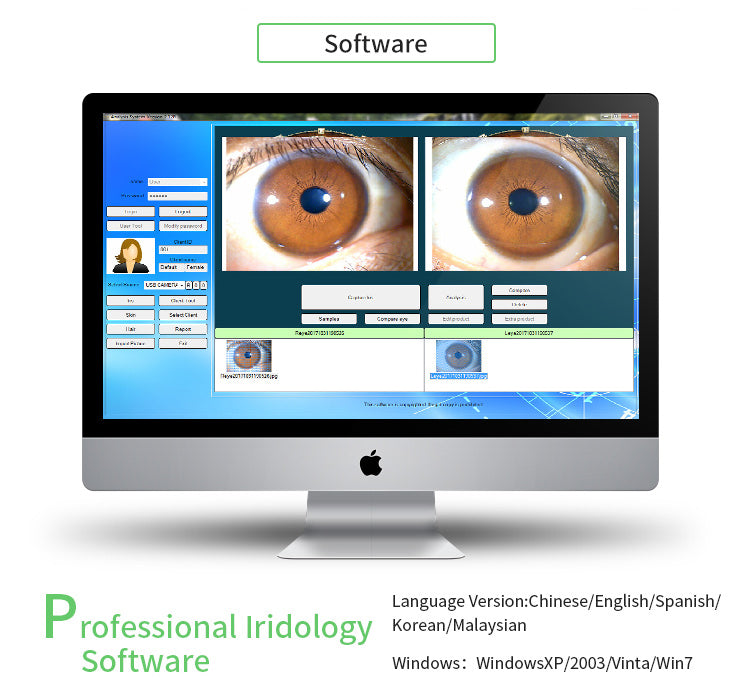 iridology camera and software