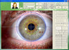 Image of iridology camera and software