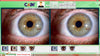 Image of iridology camera and software